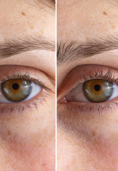 izgled trepavica pre i posle primene StylPro Heated Lash Curler uređaja